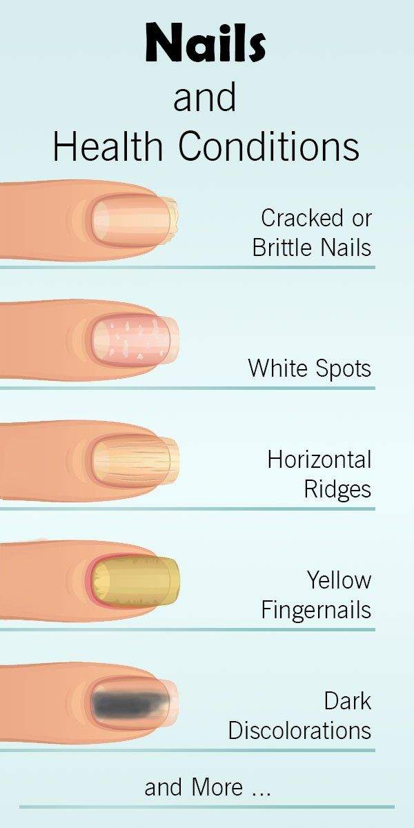 What do your nails say about your health?